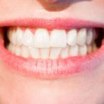 teeth-1652976__480